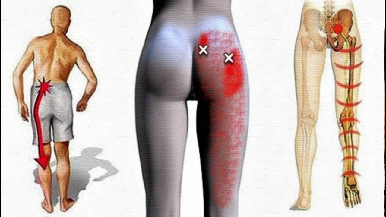 Почему болит поясница у тех, кто весь день на ногах
